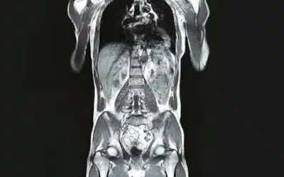 Full Body MRI Available!
